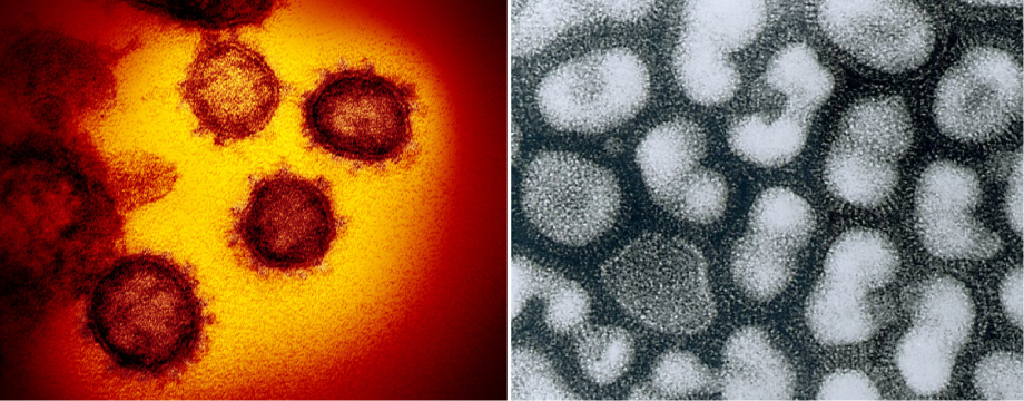 【写真】新型コロナウイルスとインフルエンザAウイルス