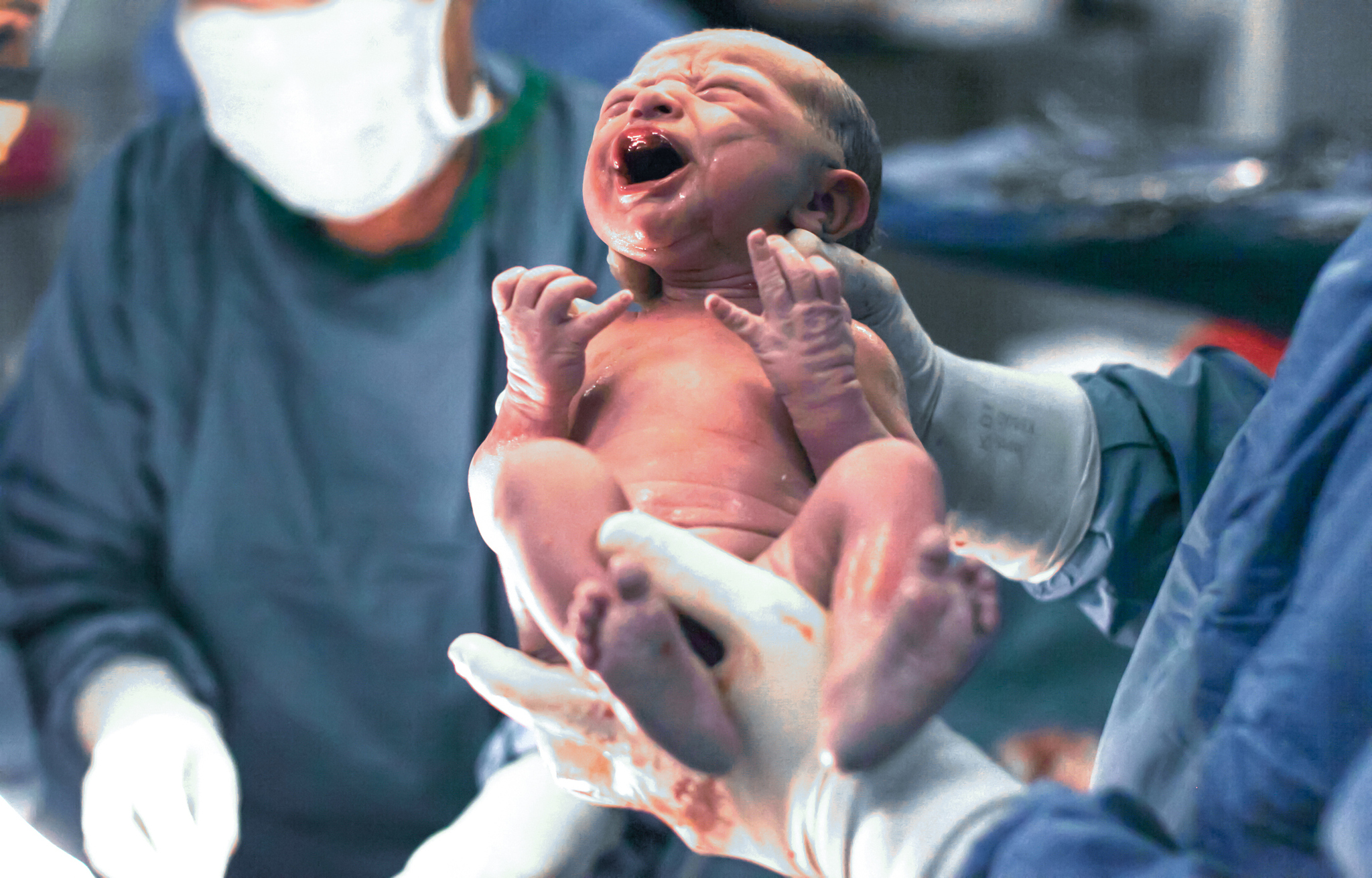 【写真】医療の進歩により、多胎児出産を含むハイリスク妊娠の事故も減った