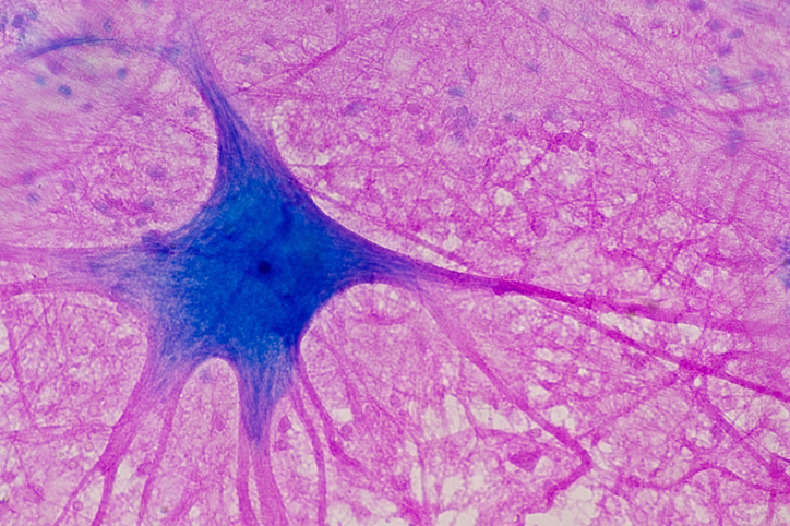 【写真】脊髄の神経細胞の細胞体