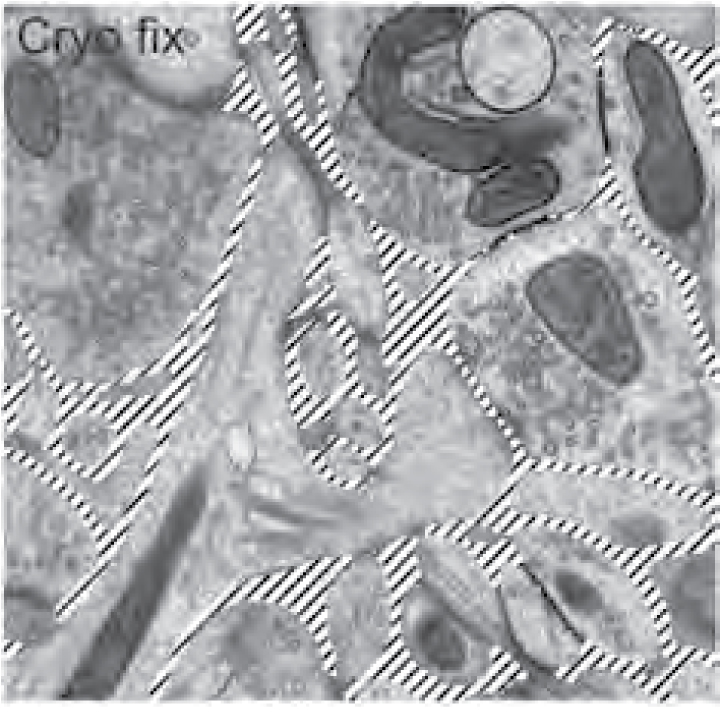 【写真】クライオ電子顕微鏡で観察した脳組織