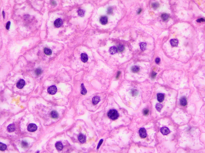 【写真】光学顕微鏡で見たヒト肝細胞