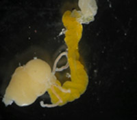[図3]チャバネアオカメムシから摘出した消化管の後部。黄色い部分が共生細菌の棲息する中腸共生器官（左の丸い部分は後腸）
