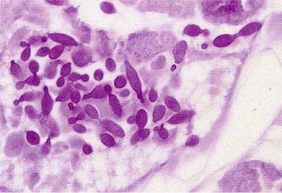 [図1-a]ササマルアブラムシ体内の共生真菌