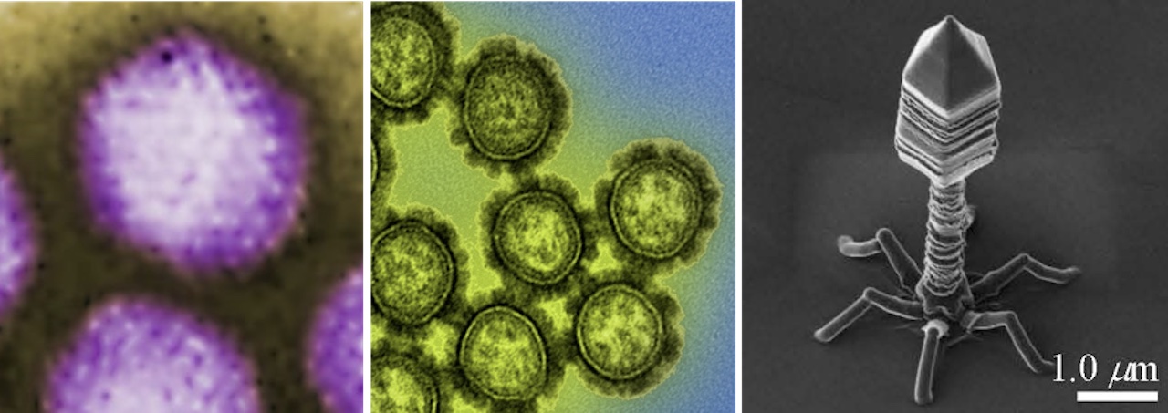 【写真】アデノウイルスとインフルエンザウイルスの着色された透過型電子顕微鏡写真（左、中）、およびバクテリオファージの走査型電子顕微鏡写真