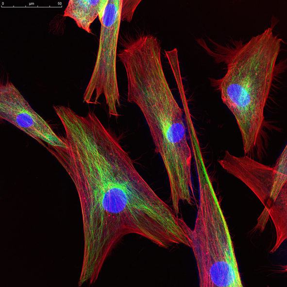 【写真】培養されているヒト皮膚細胞の蛍光顕微鏡写真